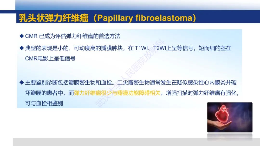 影像PPT - 【PPT】心脏原发肿瘤MR诊断-17