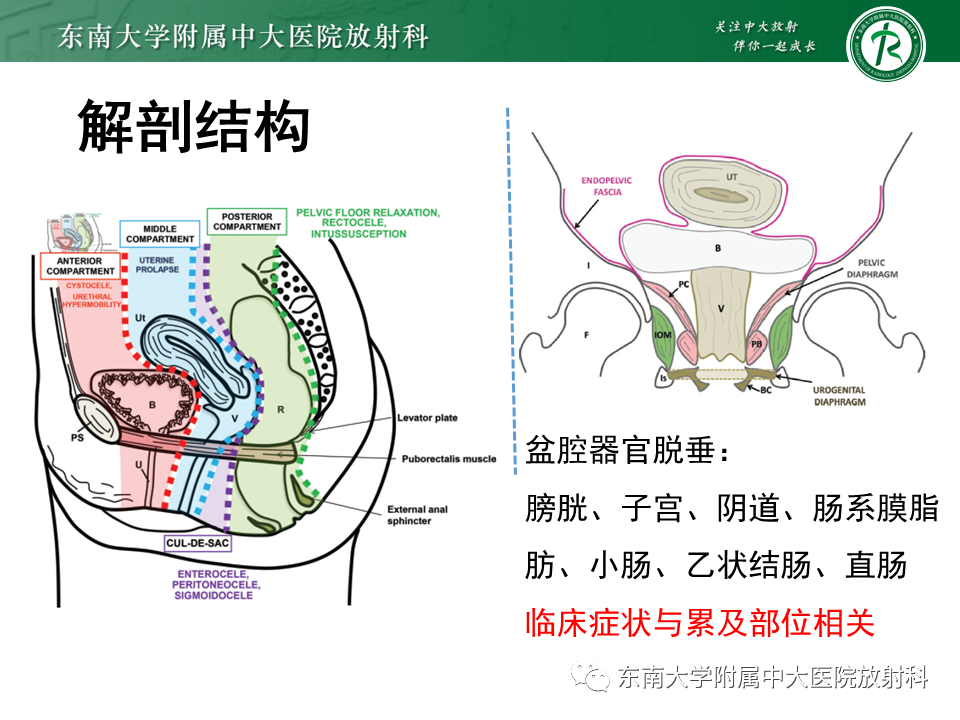 影像PPT - 【PPT】盆腔脏器脱垂—MR影像-6