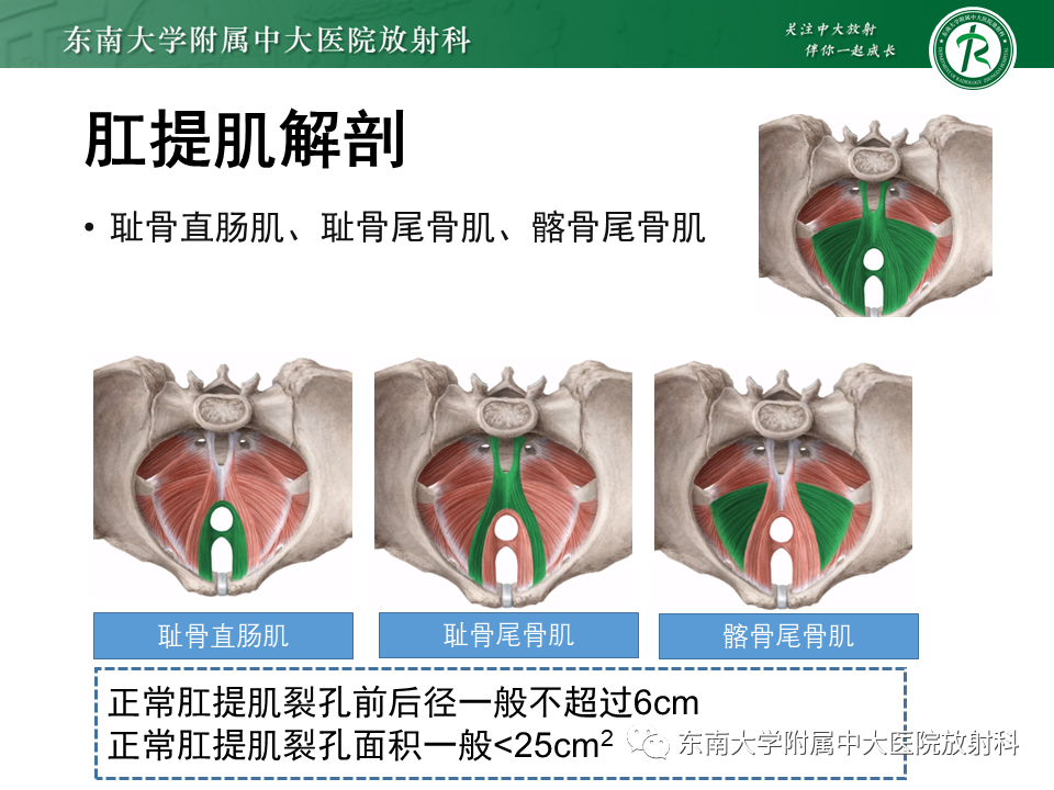 影像PPT - 【PPT】盆腔脏器脱垂—MR影像-7