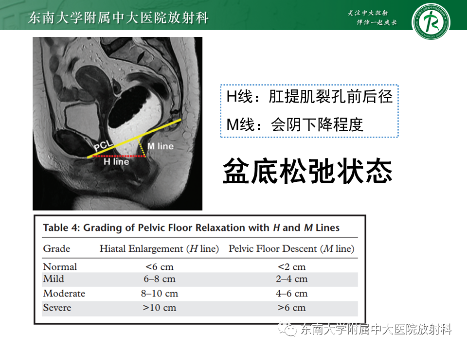 影像PPT - 【PPT】盆腔脏器脱垂—MR影像-18