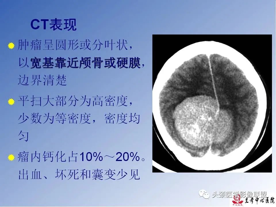 影像PPT - 【PPT】颅脑常见肿瘤影像诊断及鉴别-32
