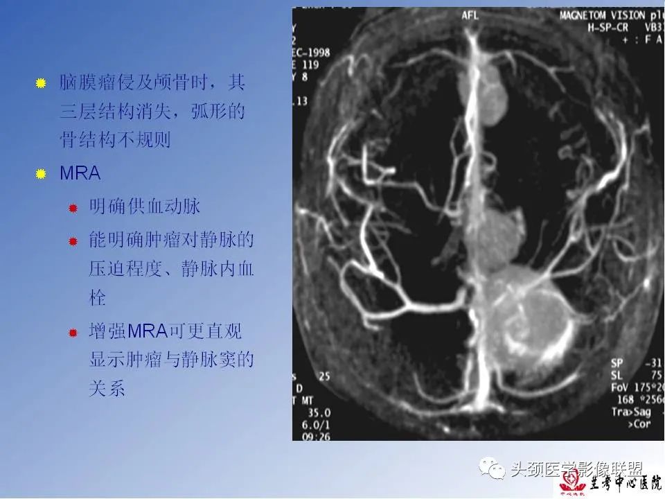 影像PPT - 【PPT】颅脑常见肿瘤影像诊断及鉴别-38
