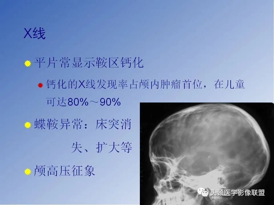 影像PPT - 【PPT】颅脑常见肿瘤影像诊断及鉴别-54