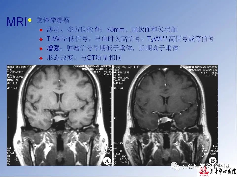 影像PPT - 【PPT】颅脑常见肿瘤影像诊断及鉴别-68