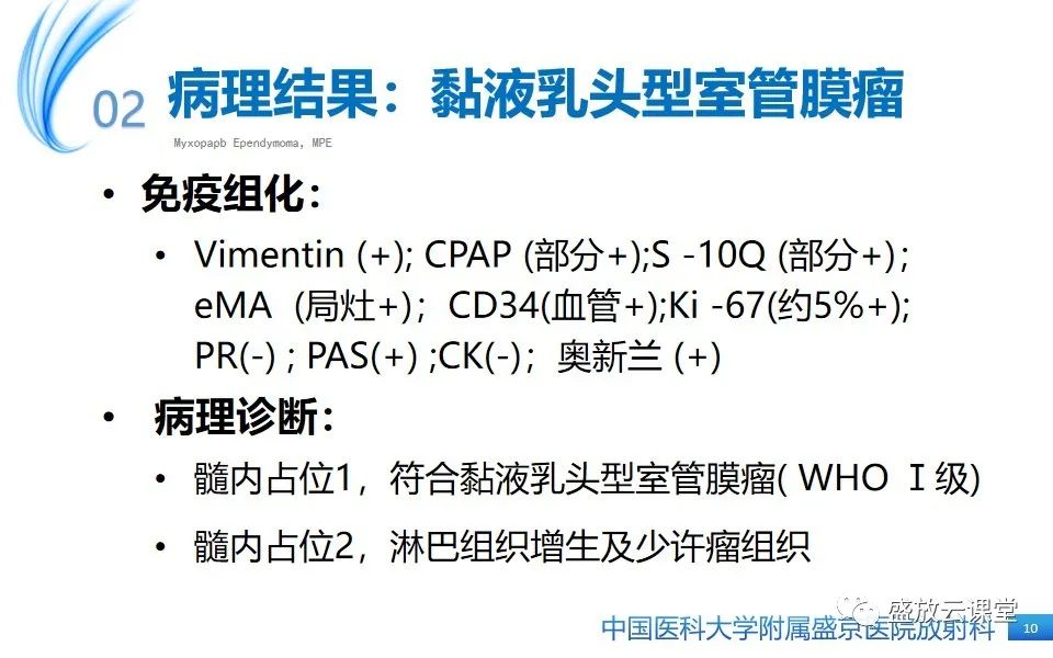 影像PPT - 【PPT】圆锥马尾型粘液乳头型室管膜瘤-10