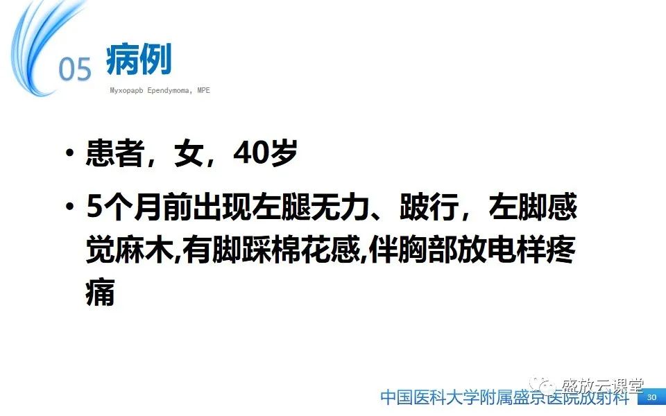 影像PPT - 【PPT】圆锥马尾型粘液乳头型室管膜瘤-30