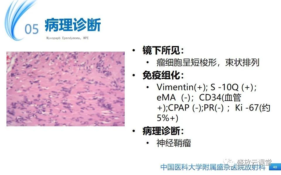 影像PPT - 【PPT】圆锥马尾型粘液乳头型室管膜瘤-40