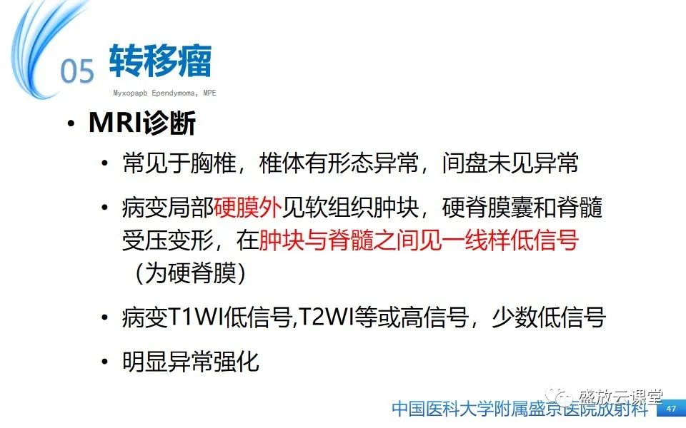 影像PPT - 【PPT】圆锥马尾型粘液乳头型室管膜瘤-47