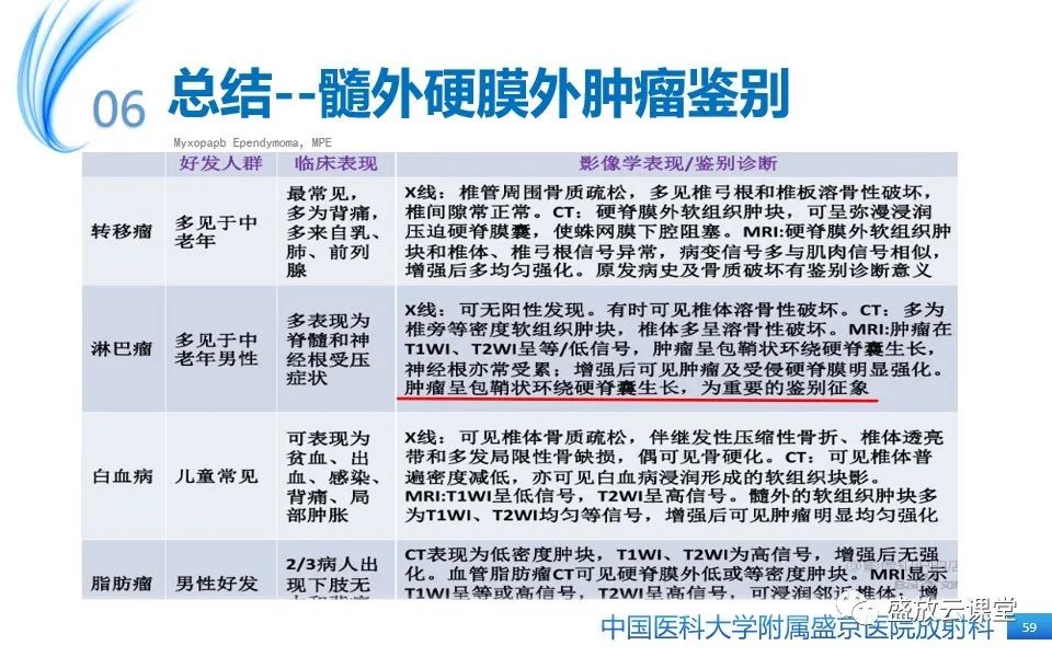 影像PPT - 【PPT】圆锥马尾型粘液乳头型室管膜瘤-59
