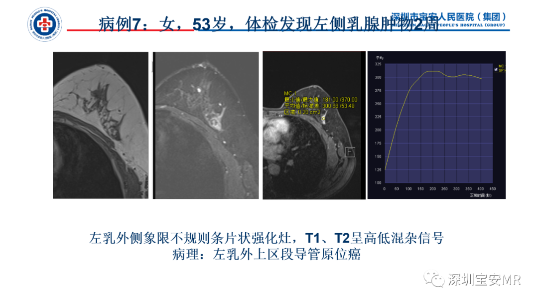 影像PPT - 【PPT】乳腺脂肪(Fat Necrosis)坏死影像表现-20