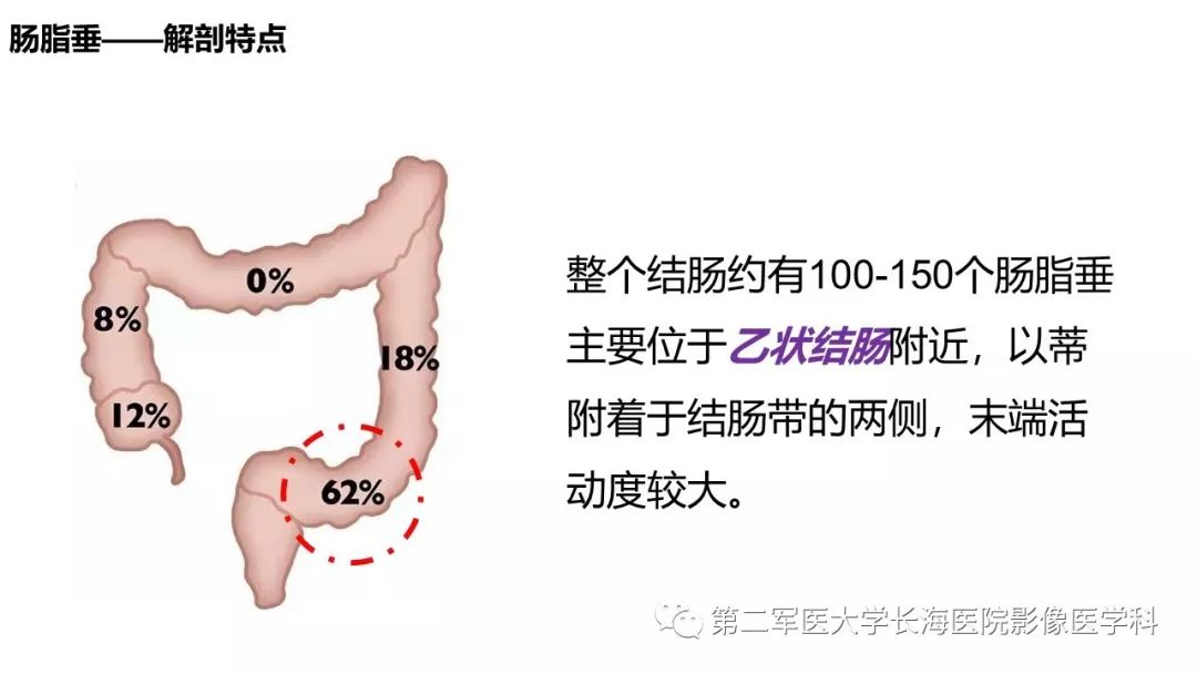 影像PPT - 【PPT】急性原发性肠脂垂炎CT诊断与鉴别诊断-5