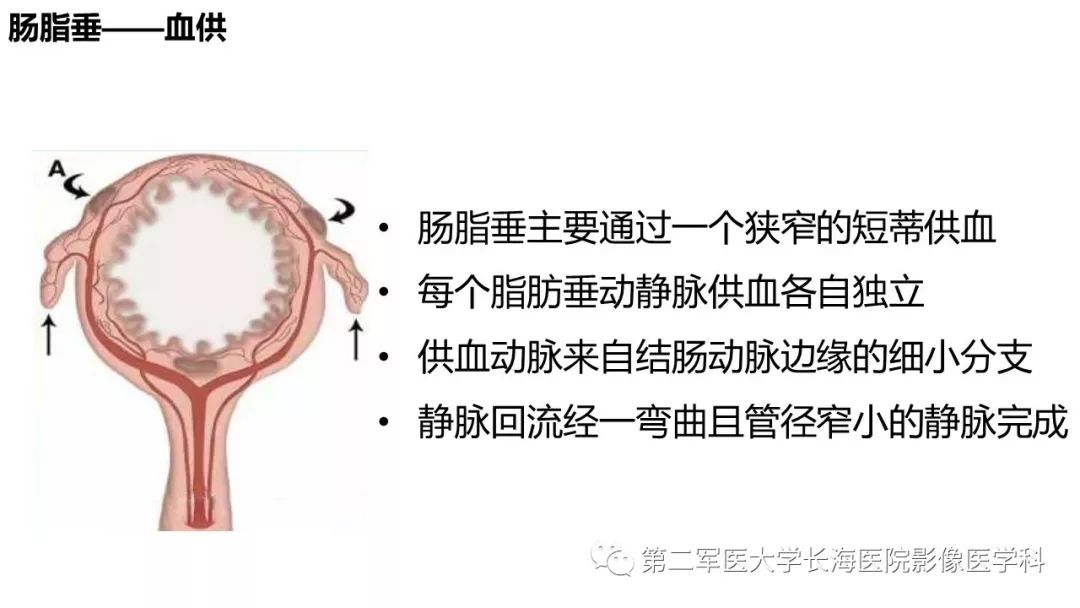 影像PPT - 【PPT】急性原发性肠脂垂炎CT诊断与鉴别诊断-6