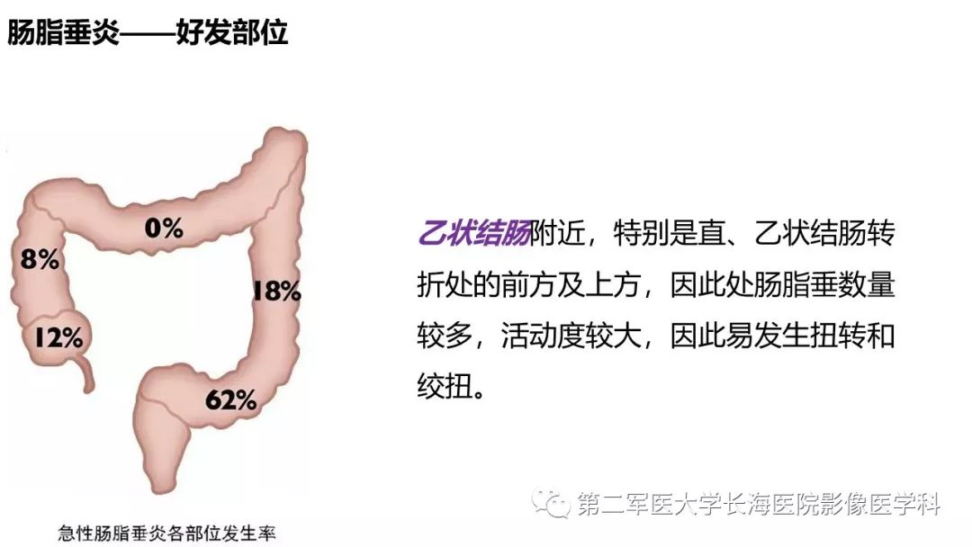影像PPT - 【PPT】急性原发性肠脂垂炎CT诊断与鉴别诊断-14