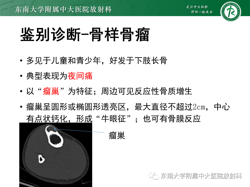影像PPT - 【PPT】应力性骨折-24