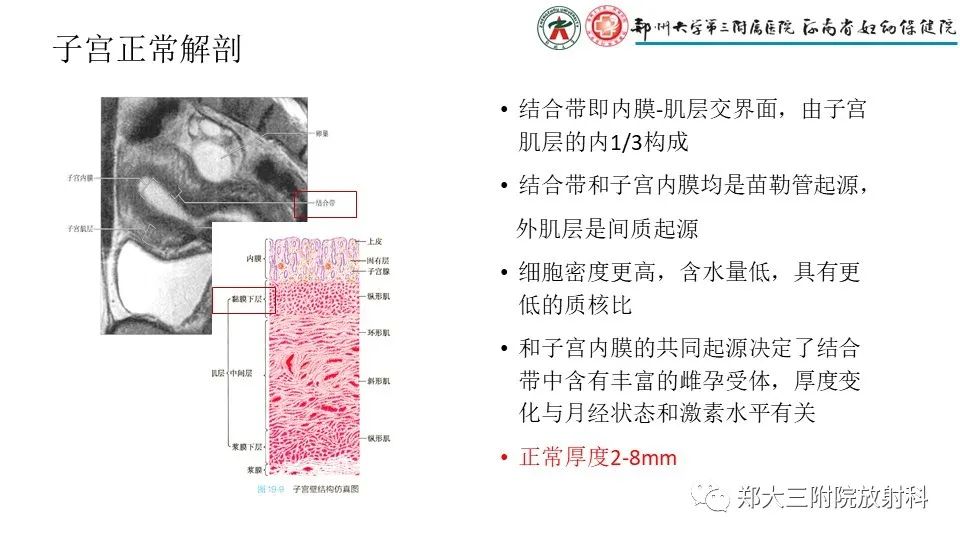 影像PPT - 【PPT】子宫腺肌症的MRI表现-5