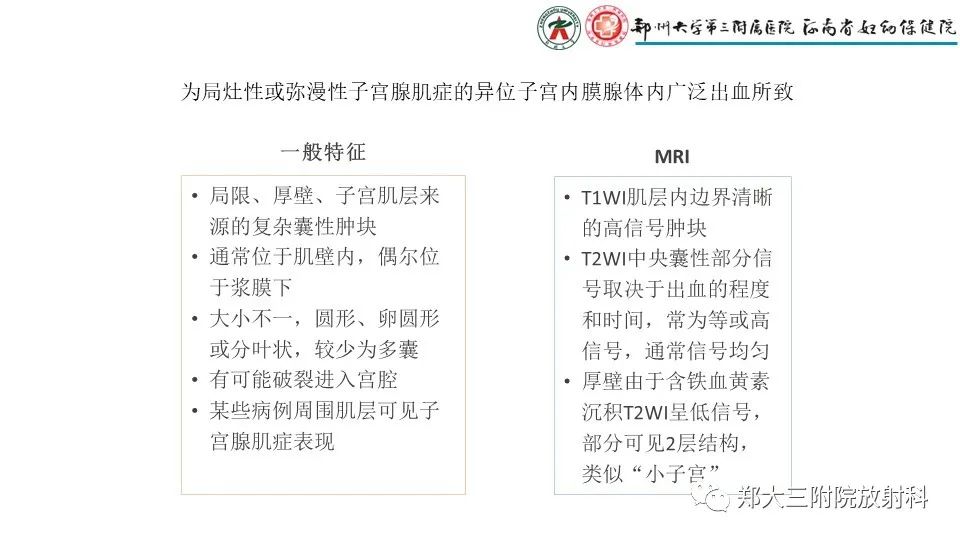 影像PPT - 【PPT】子宫腺肌症的MRI表现-29