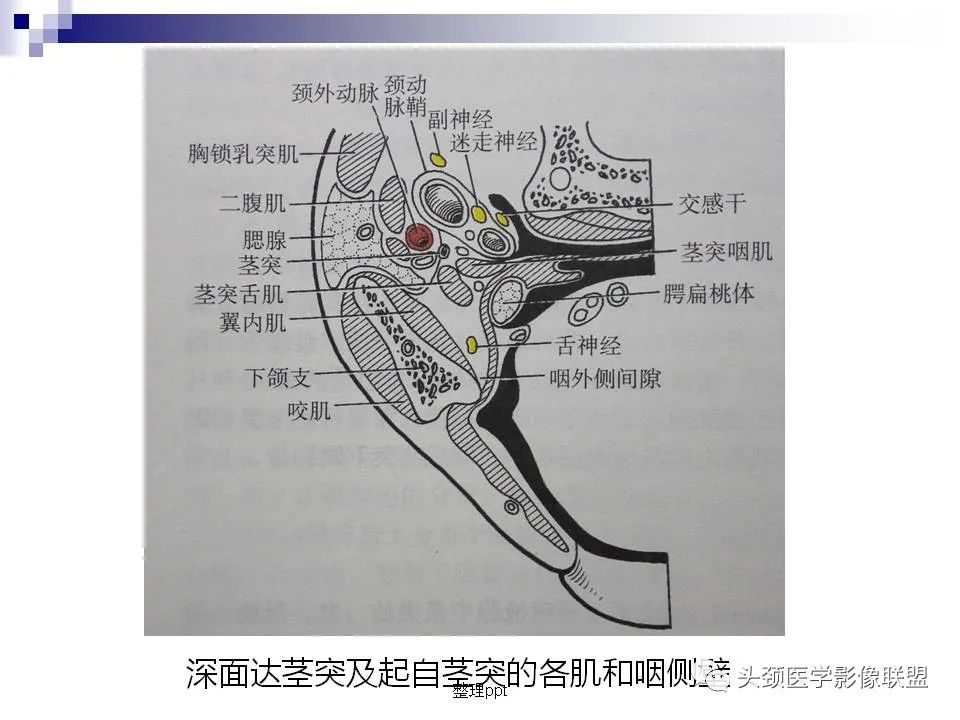 影像PPT - 【PPT】涎腺疾病的影像诊断-5