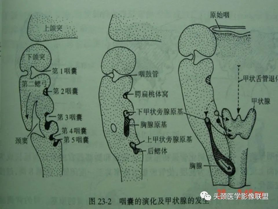 影像PPT - 【PPT】涎腺疾病的影像诊断-28
