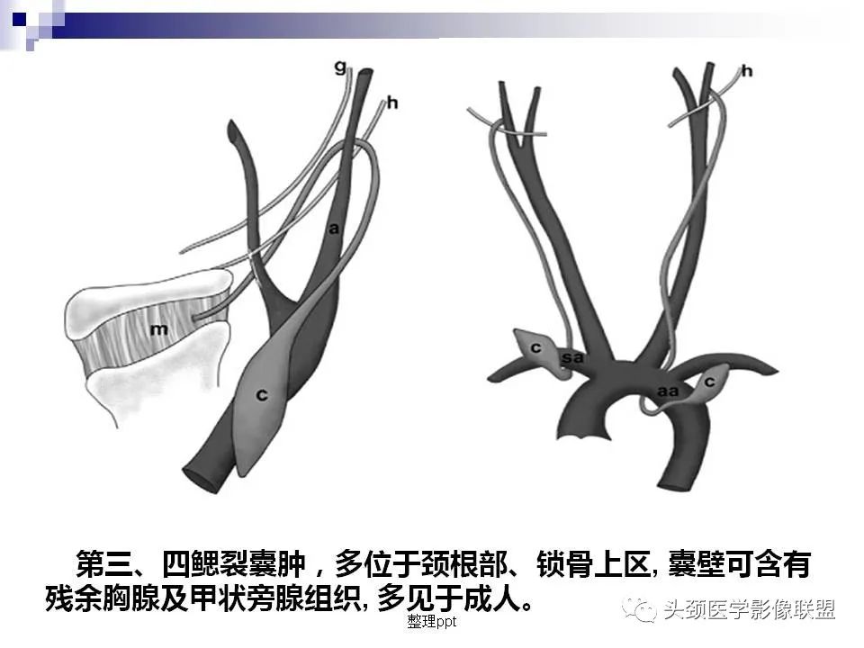影像PPT - 【PPT】涎腺疾病的影像诊断-31