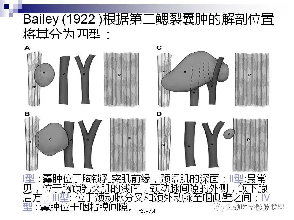 影像PPT - 【PPT】涎腺疾病的影像诊断-30