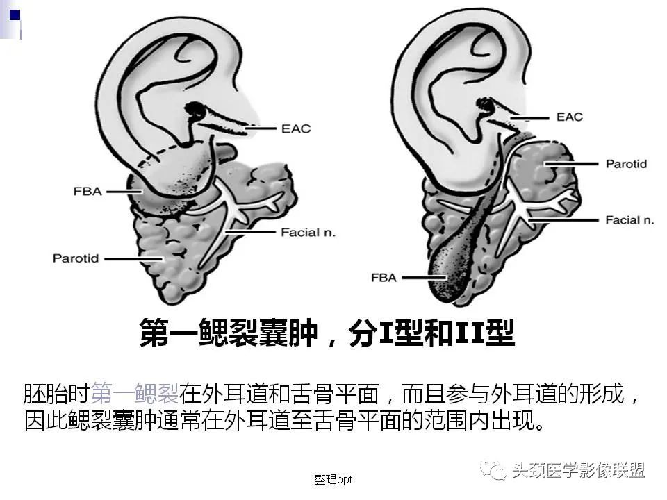 影像PPT - 【PPT】涎腺疾病的影像诊断-29