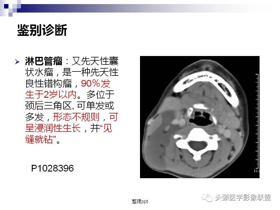 影像PPT - 【PPT】涎腺疾病的影像诊断-39