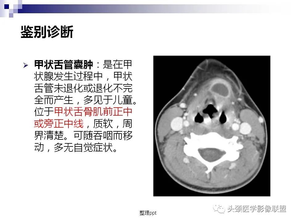 影像PPT - 【PPT】涎腺疾病的影像诊断-38
