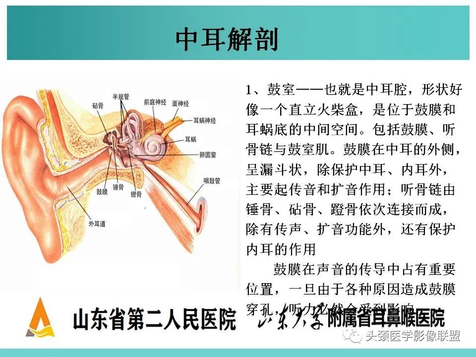 影像PPT - 【PPT】慢性中耳乳突炎-4
