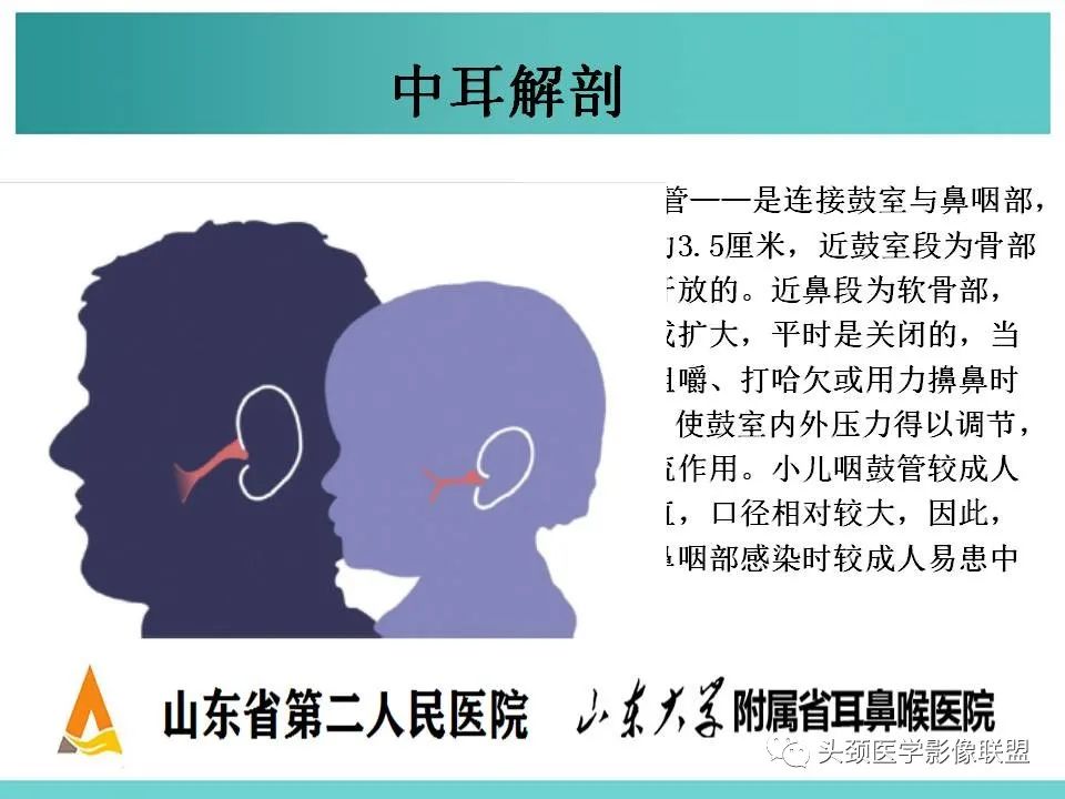 影像PPT - 【PPT】慢性中耳乳突炎-5