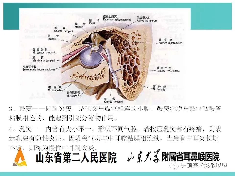 影像PPT - 【PPT】慢性中耳乳突炎-6