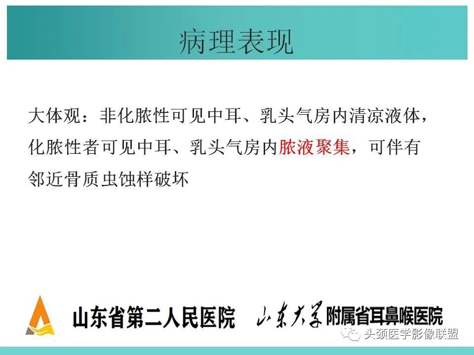 影像PPT - 【PPT】慢性中耳乳突炎-20
