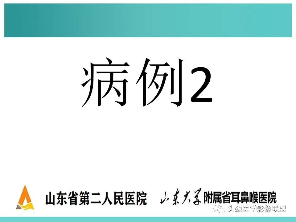 影像PPT - 【PPT】慢性中耳乳突炎-62