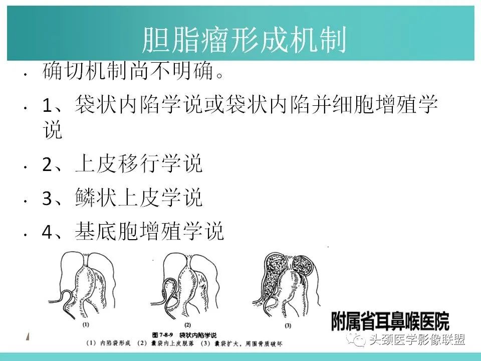 影像PPT - 【PPT】慢性中耳乳突炎-81