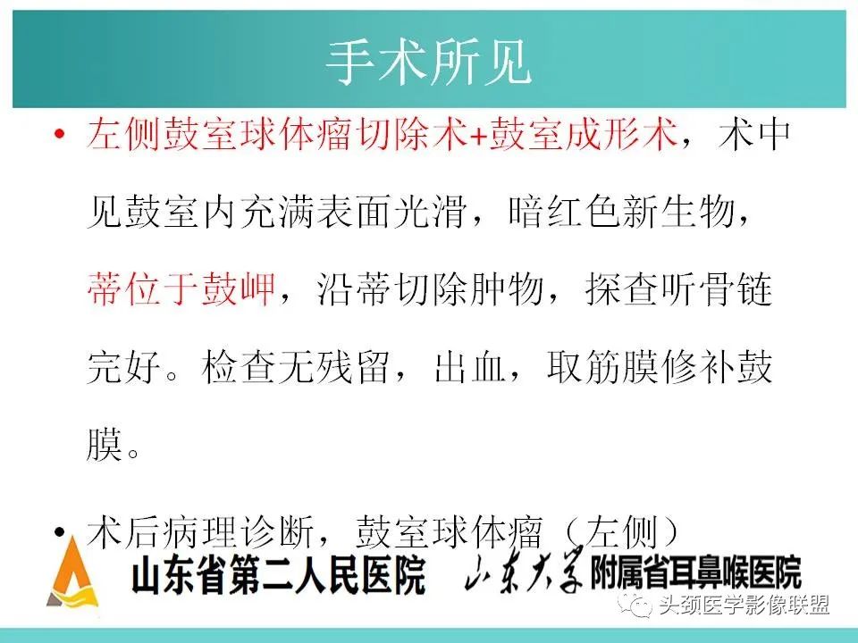 影像PPT - 【PPT】慢性中耳乳突炎-106