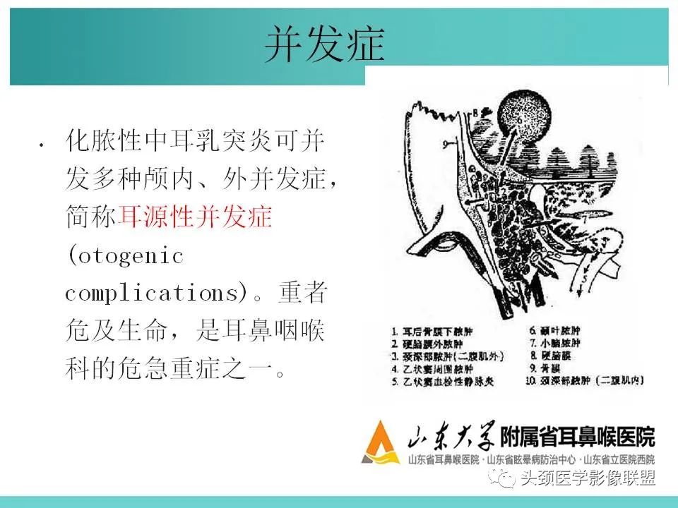 影像PPT - 【PPT】慢性中耳乳突炎-112
