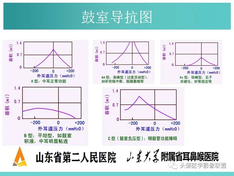 影像PPT - 【PPT】慢性中耳乳突炎-126