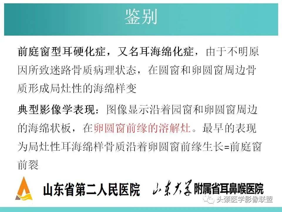 影像PPT - 【PPT】慢性中耳乳突炎-132