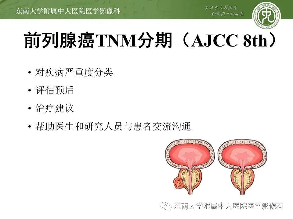 影像PPT - 【PPT】前列腺癌TNM分期-4