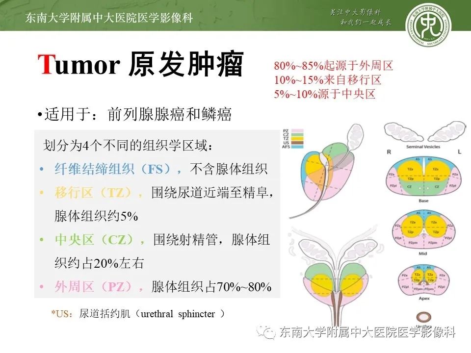 影像PPT - 【PPT】前列腺癌TNM分期-5