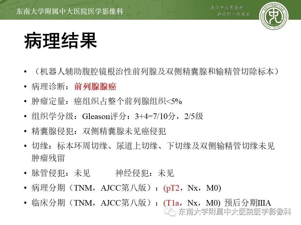 影像PPT - 【PPT】前列腺癌TNM分期-15