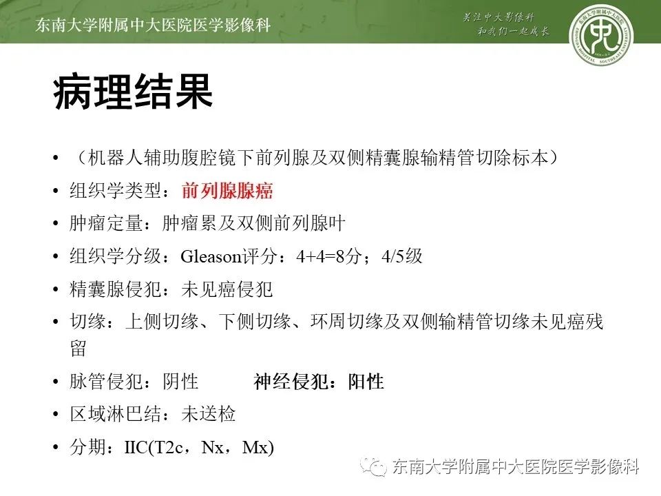 影像PPT - 【PPT】前列腺癌TNM分期-17