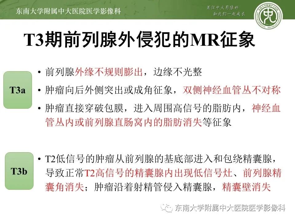 影像PPT - 【PPT】前列腺癌TNM分期-18