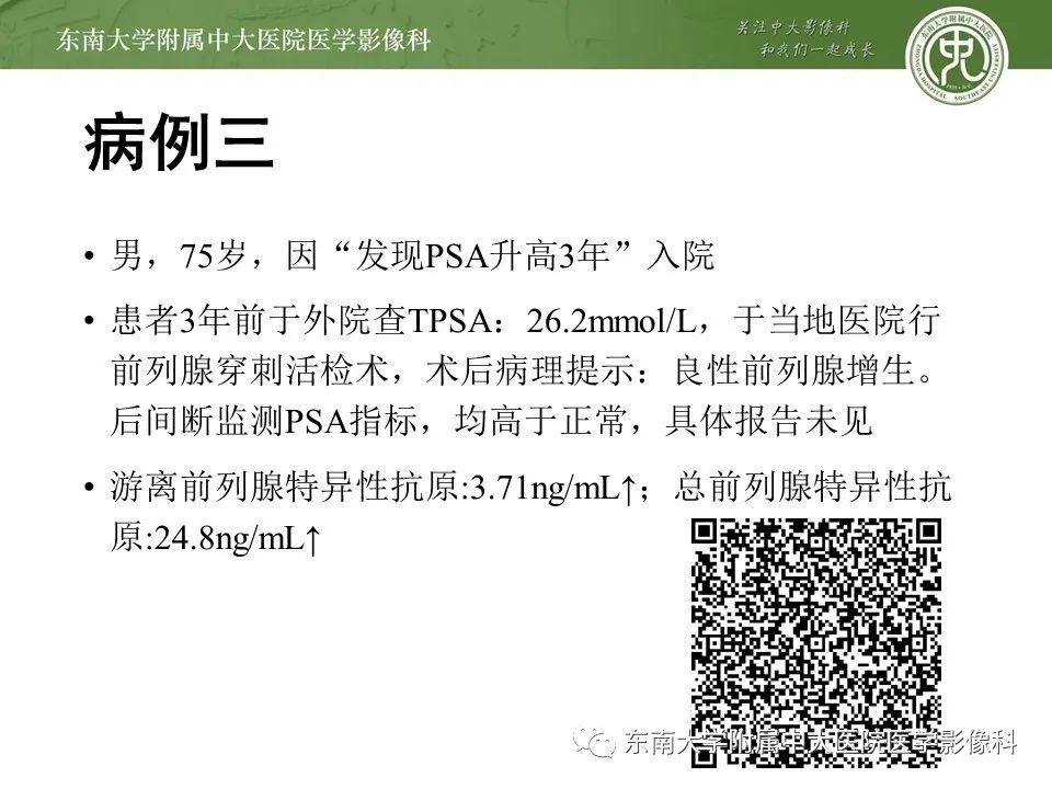 影像PPT - 【PPT】前列腺癌TNM分期-20