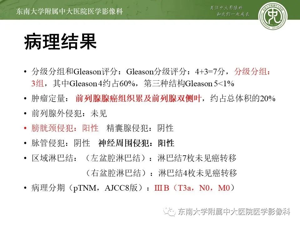 影像PPT - 【PPT】前列腺癌TNM分期-21