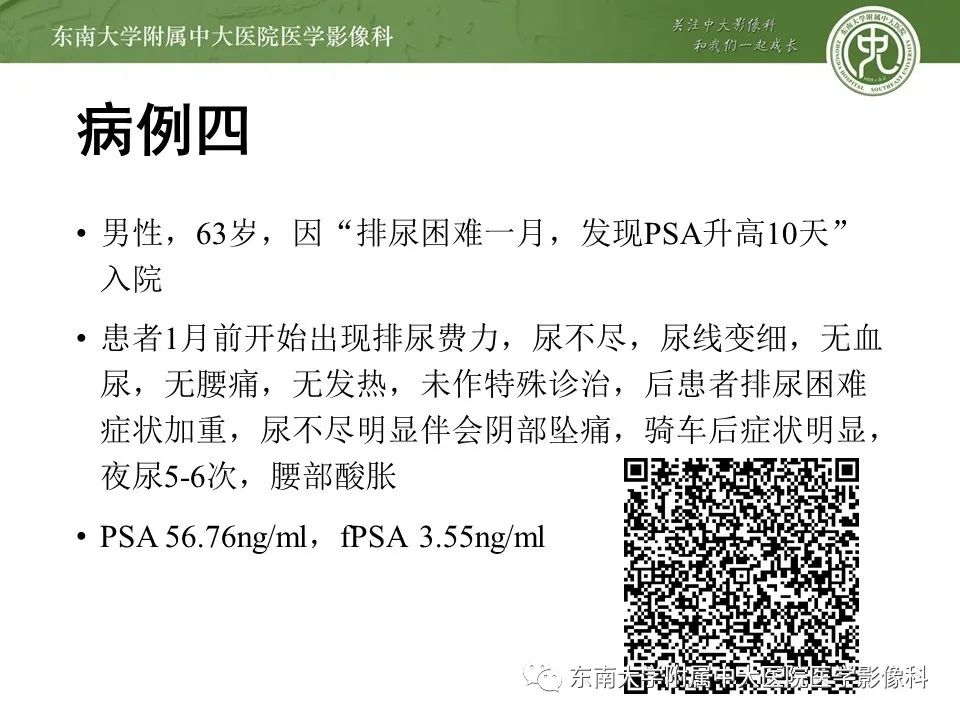 影像PPT - 【PPT】前列腺癌TNM分期-22