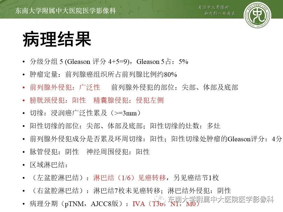 影像PPT - 【PPT】前列腺癌TNM分期-23