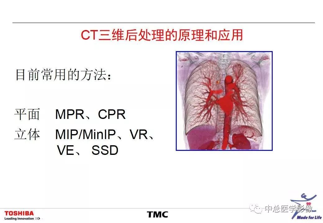 影像PPT - 【PPT】CT三维后处理技术应用-3
