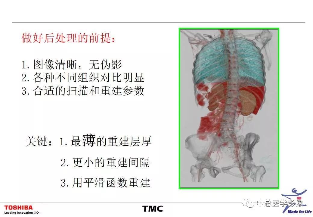 影像PPT - 【PPT】CT三维后处理技术应用-4
