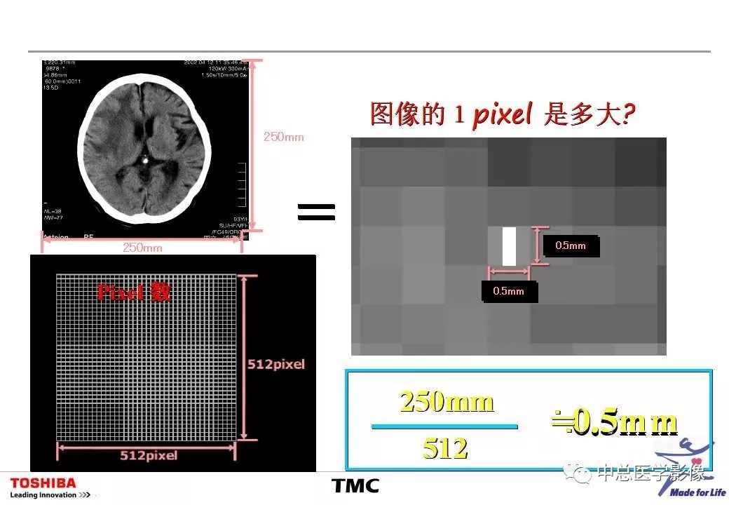 影像PPT - 【PPT】CT三维后处理技术应用-7