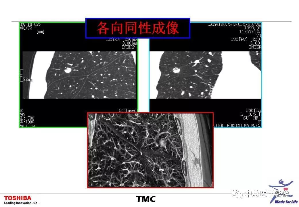 影像PPT - 【PPT】CT三维后处理技术应用-13